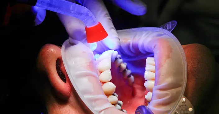 تجميل الأسنان: دليلك المتكامل لابتسامة واثقة وجذابة