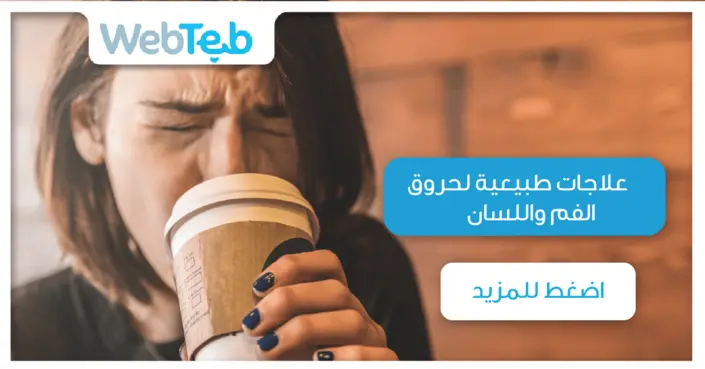 طرق فعّالة لعلاج حروق الفم واللسان طبيعيًا في المنزل &#8211; دليلك الشامل