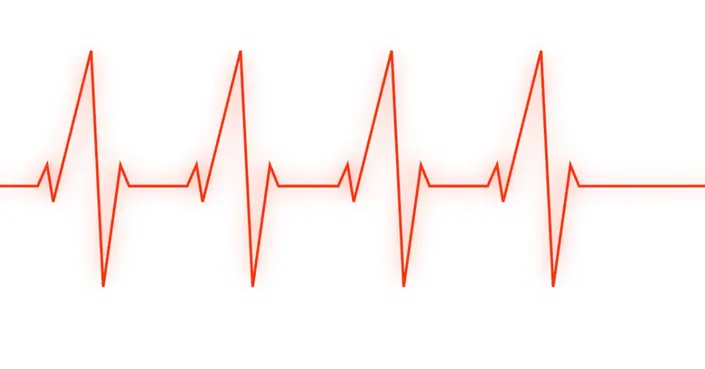 متى تحتاج إلى تخطيط القلب؟ دليل شامل لأهميته ودواعي إجرائه
