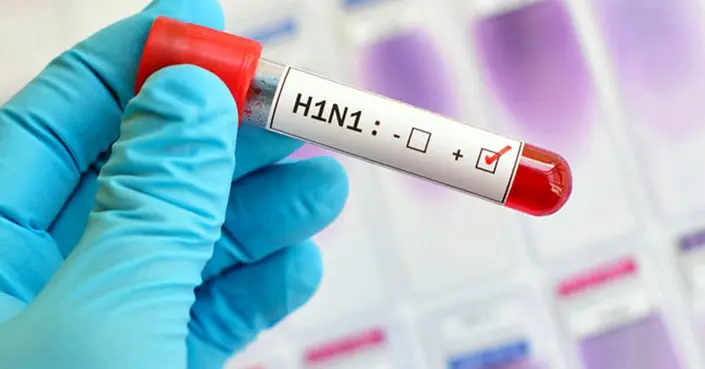 أنفلونزا الخنازير (H1N1): دليلك الشامل للأعراض والوقاية والعلاج