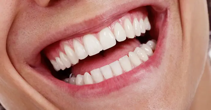كم عدد أسنان الإنسان حقًا؟ دليل شامل لأسنانك الصحية