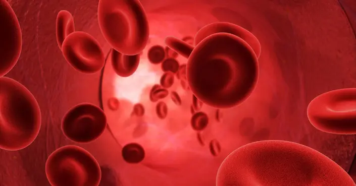 فرط لزوجة الدم: دليل شامل للأسباب، الأعراض، وطرق العلاج الفعالة