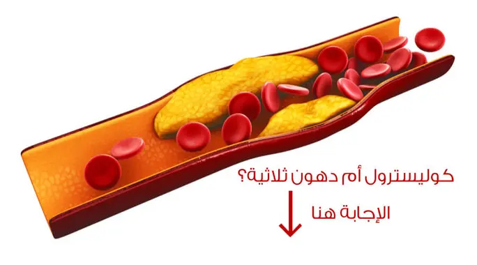 الكولسترول والدهون الثلاثية: ما الفرق وأيهما أخطر على صحتك؟
