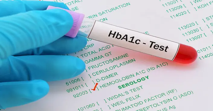 فحص الهيموغلوبين السكري HBa1c: دليلك الشامل لفهم أهميته ونتائجه
