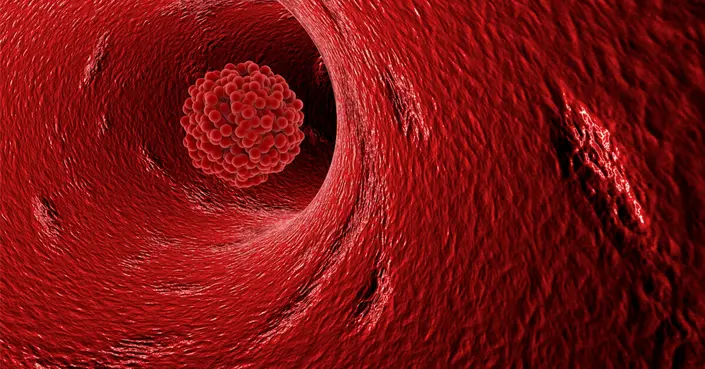 دليلك الشامل: أسباب تجلّط الدم وكيف تحمي نفسك منه