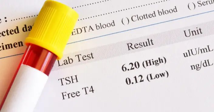 كشف الأعراض: كل ما تحتاج معرفته عن علامات ارتفاع هرمون الغدة الدرقية TSH
