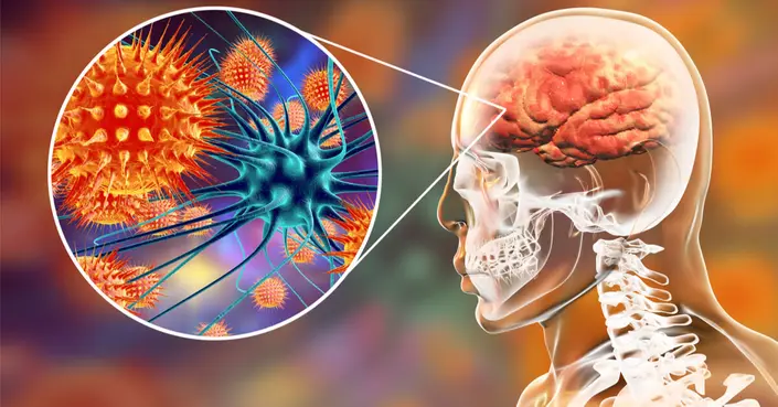 كيف ينتقل مرض السحايا؟ دليلك الشامل للعدوى والوقاية