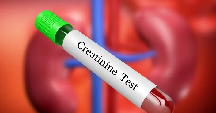 أعراض ارتفاع الكرياتينين: دليلك الكامل لفهم مؤشرات الكلى
