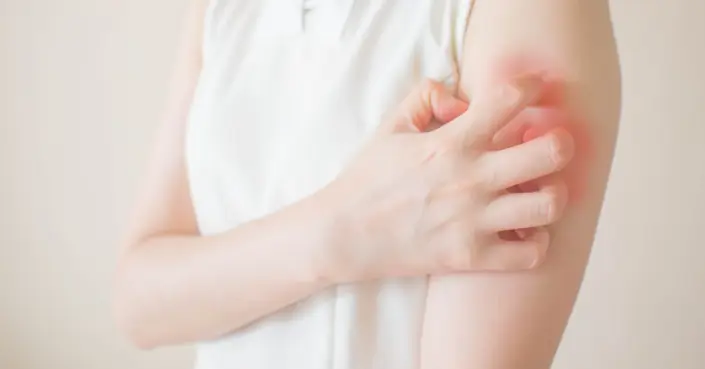 اكتشف أبرز أنواع الفطريات الجلدية الشائعة: الدليل الكامل للتعرف والعلاج