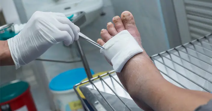 أعراض القدم السكري ومضاعفاتها: دليلك الشامل لحماية قدميك من الخطر