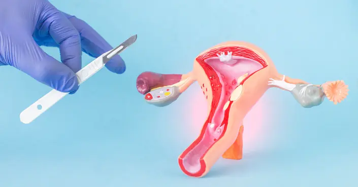 اكتشفي أعراض التصاقات الرحم: دليلك الكامل للتشخيص والعلاج
