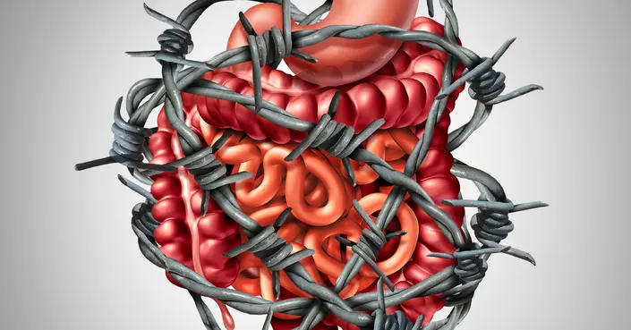 أضرار الإمساك المزمن: دليلك الشامل للمضاعفات وكيفية الوقاية