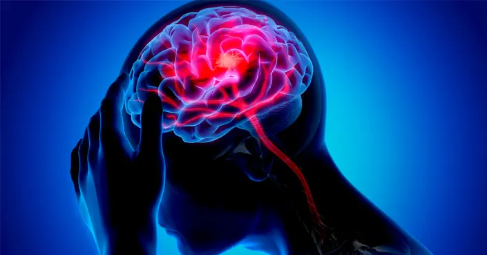 أعراض الجلطة الدماغية والغيبوبة: علامات حاسمة تتطلب تصرفاً فورياً