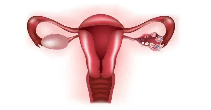 الفرق بين الكيس والتكيس في المبايض: دليل شامل لصحتك الإنجابية