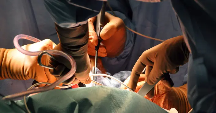 عملية تطويل القامة: دليل شامل لكل ما تحتاج معرفته عن جراحة زيادة الطول