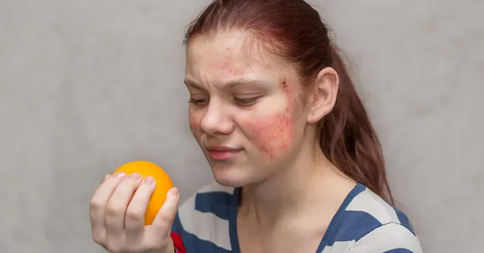 ما هي حساسية الطعام المتأخرة؟ دليل شامل لفهم أعراضها وأسبابها وعلاجها