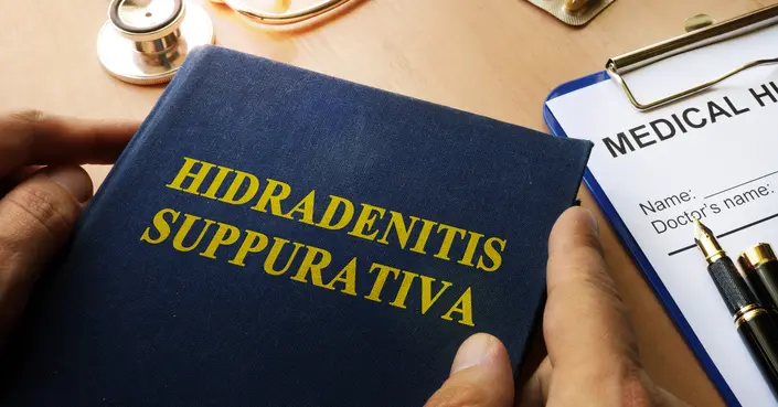 دمامل الغدد العرقية: دليل شامل للأسباب، الأعراض، والعلاج الفعّال