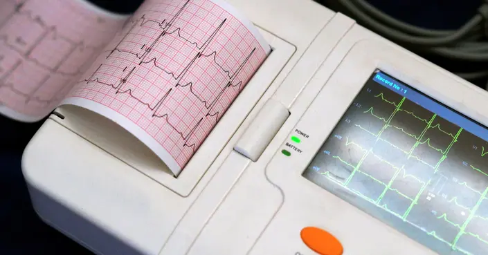 تخطيط كهربائية القلب: دليلك الشامل لفهم هذا الفحص الحيوي لصحة قلبك
