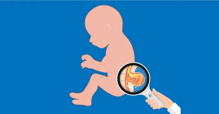 تشقق العمود الفقري: دليل شامل لفهم الأسباب، الأعراض والعلاج