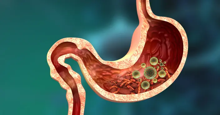 أعراض الالتهاب المعوي: دليل شامل للعلامات، الأسباب، والوقاية