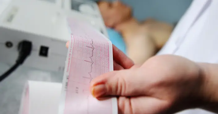 الكشف المبكر والتشخيص الدقيق: استكشف فوائد تخطيط القلب الكهربائي (ECG) لصحة قلبك