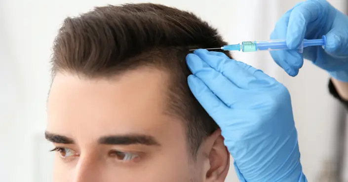 زراعة الشعر: نصائح حاسمة لنتائج تدوم وشفاء سريع