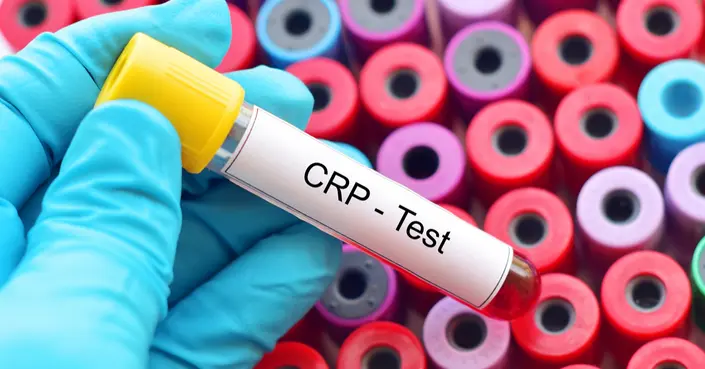 تحليل CRP: دليلك الشامل لفهم نتائجه وأسباب ارتفاعه