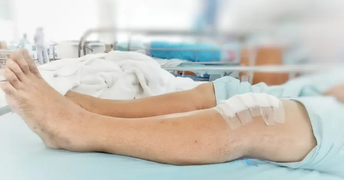 دليلك الشامل للتعافي: أهم نصائح ما بعد عملية غضروف الركبة