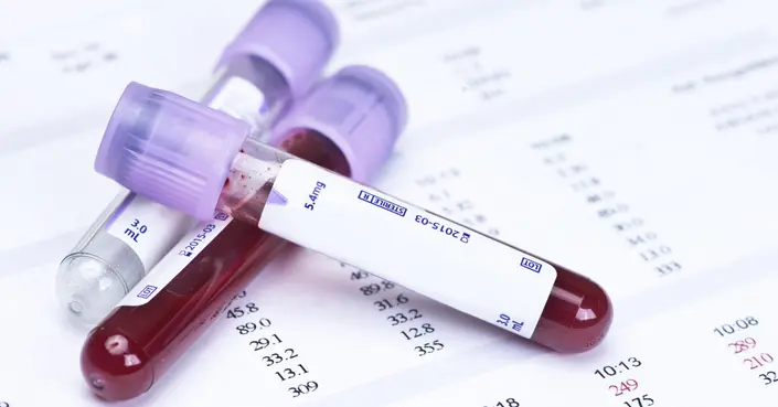 هل يكشف تحليل الدم الشامل الإيدز؟ الحقيقة الكاملة حول فحص فيروس HIV