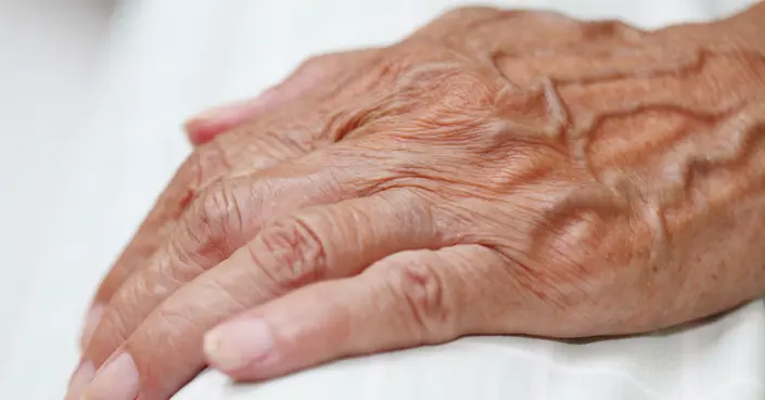 لماذا تنتفخ عروق يديك؟ أسباب انتفاخ عروق اليد وطرق العلاج