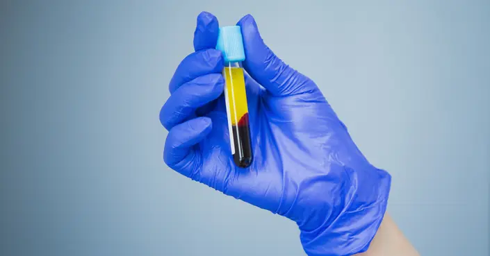 تحليل Platelets: دليلك الشامل لفهم فحص الصفائح الدموية ونتائجه