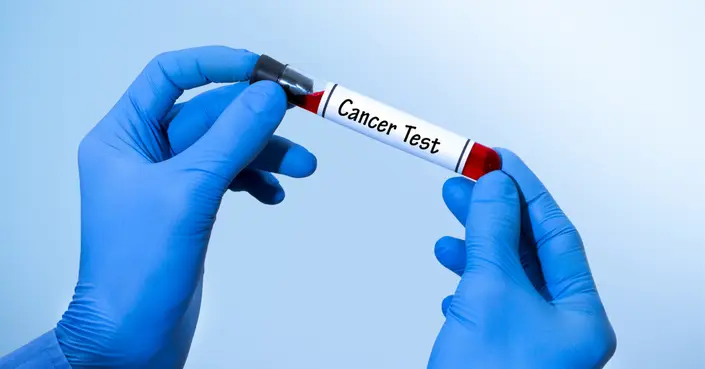 Can Tumors Be Detected in Blood Tests? A Comprehensive Guide to Diagnosis
