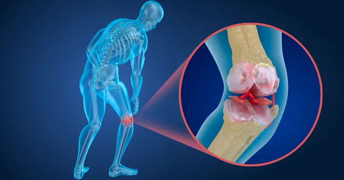 تآكل غضروف الركبة: الأسباب، الأعراض، وخيارات العلاج الحديثة لاستعادة الحركة