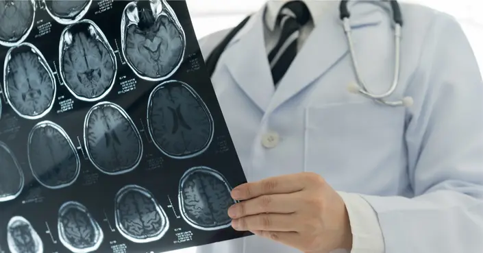تشخيص التهاب السحايا: دليلك الشامل لأبرز الأعراض وطرق العلاج الفعالة