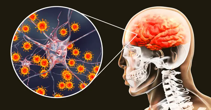 مضاعفات التهاب السحايا: دليل شامل للتعامل مع آثاره المحتملة