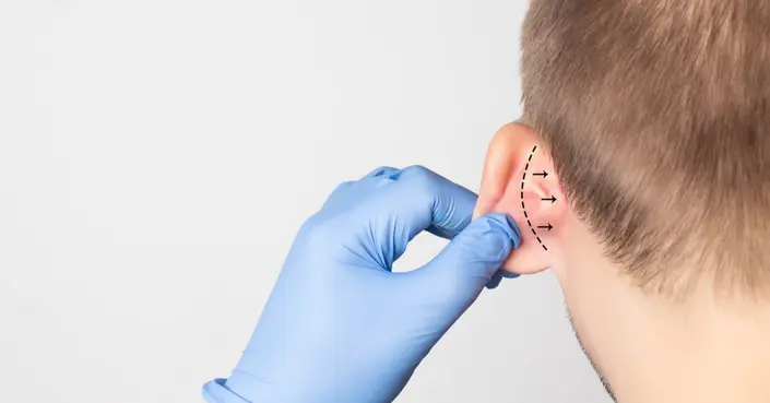 عملية تجميل الأذن: دليلك الشامل لنتائج طبيعية وجذابة
