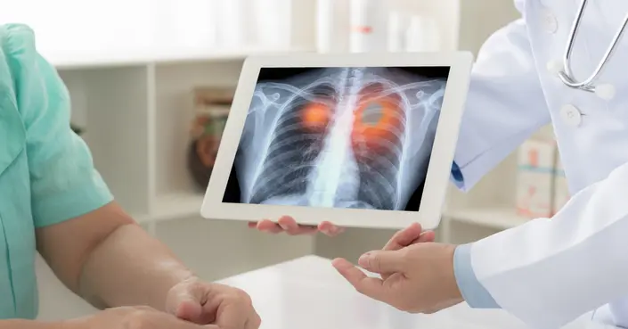 دليلك الشامل لتحليل السل: الأنواع، المخاطر، ومتى يجب إجراؤه