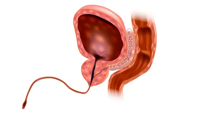 علاج التهاب الإحليل: دليل شامل للتشخيص، العلاج، والوقاية من المضاعفات