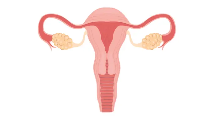 تقوية عنق الرحم: دليلك الشامل لحمل آمن وصحة جنينك