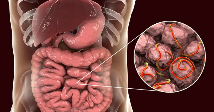 مضاعفات داء السرميات: دليل شامل لفهم المخاطر والوقاية منها