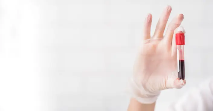 تحليل CEA: فهم شامل لأهمية هذا الفحص ونتائجه