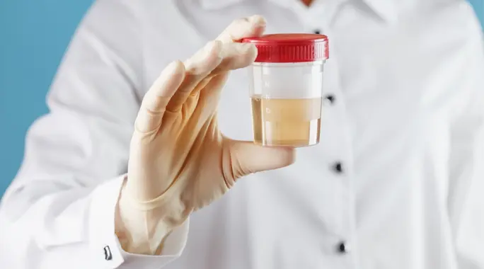 شحوم البول: دليل شامل لأسبابها، أعراضها وكيفية التعامل معها