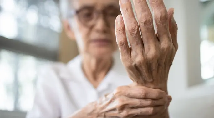 اكتشف أسباب بروز عظام أصابع اليد: دليل شامل للعوامل والعلاج