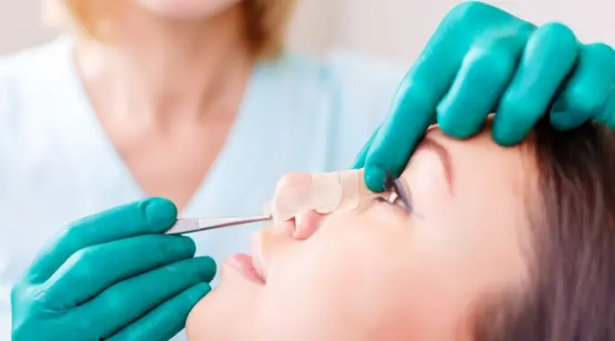 وداعًا لتورم الأنف بعد عملية التجميل: دليلك الشامل لتعافٍ سريع ومثالي
