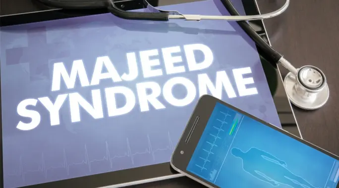 مرض مجيد: الدليل الشامل لأعراضه، أسبابه وعلاجه