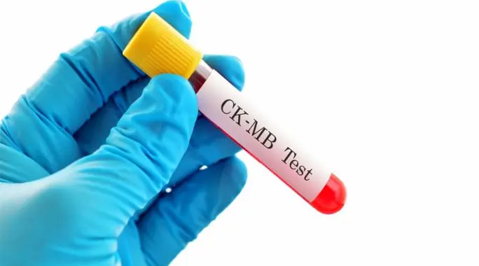تحليل CK-MB: دليل شامل لفهم أهميته، نتائجه، وأسباب ارتفاعه