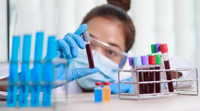 تحليل SMA: دليلك الشامل لفهم هذا الاختبار الحيوي