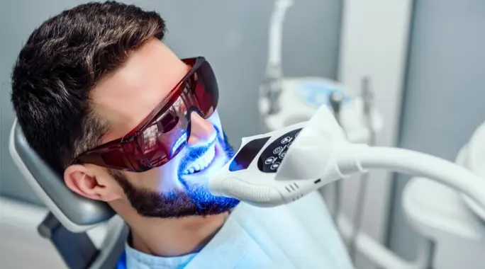 تبييض الأسنان بالليزر: هل تستحق المخاطرة؟ أضرار وفوائد يجب أن تعرفها