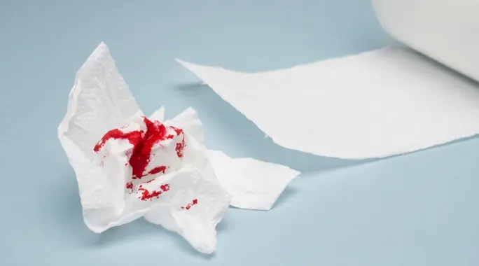 دليل شامل: طرق فعالة في علاج نزيف البواسير واستعادة راحتك