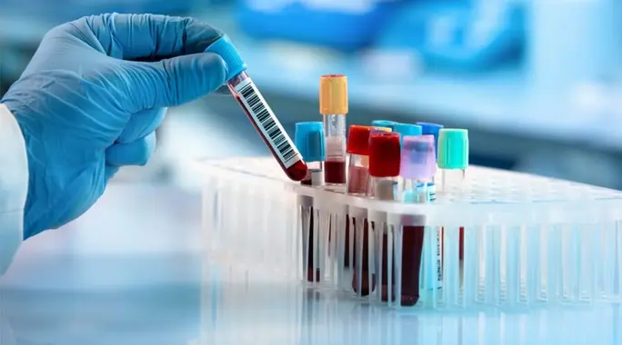 طرق تشخيص الفطريات: دليلك لفهم أنواع الفحوصات وعلاج العدوى